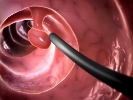 Credit: Thinkstock/Eraxion