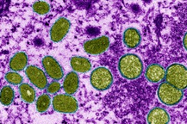 Photo credit: CDC/CYNTHIA S. GOLDSMITH/SCIENCE SOURCE